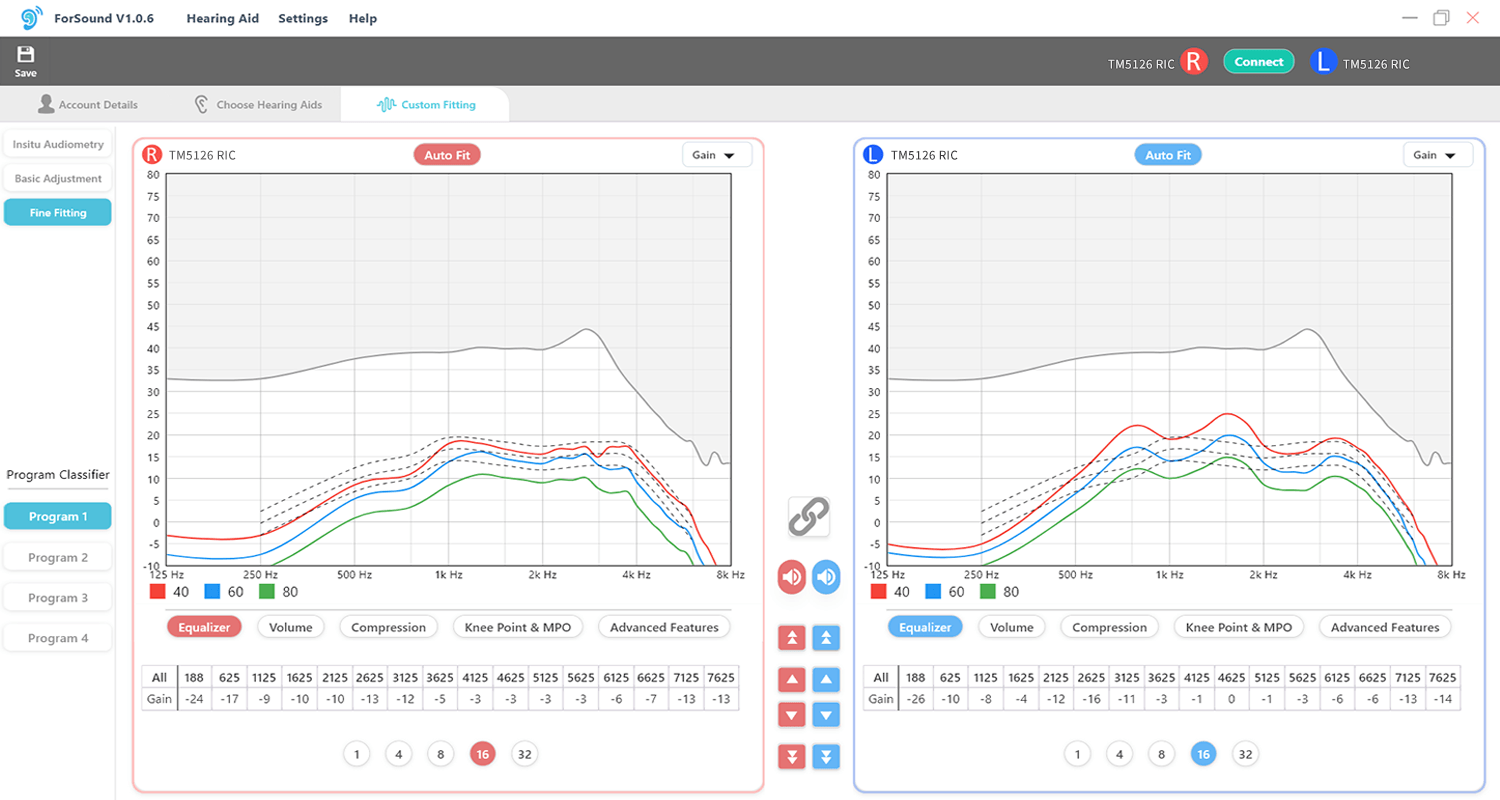 Professional-grade hearing aid fitting software