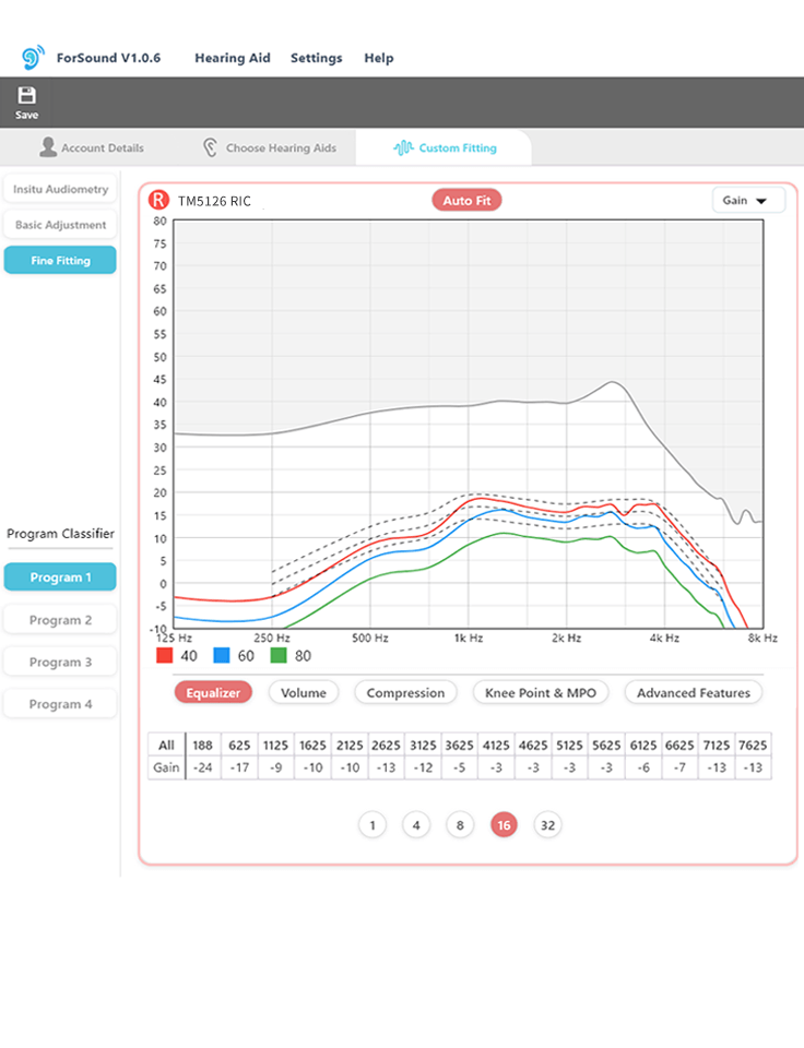 Professional-grade hearing aid fitting software